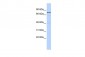 WBP11 antibody - N-terminal region